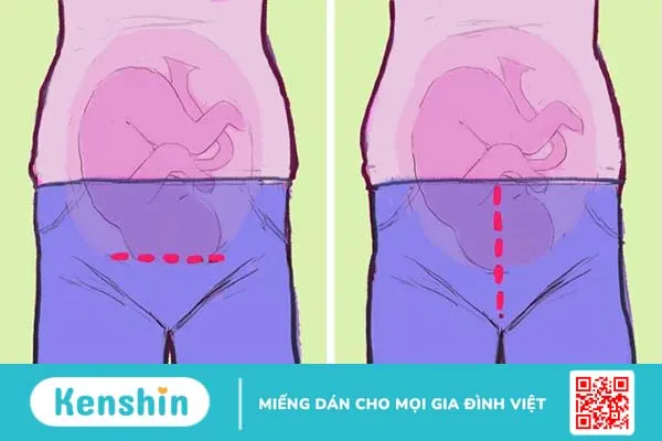 10 lợi ích và rủi ro bạn có thể gặp phải nếu sinh con ở độ tuổi 20 so với tuổi 30 3