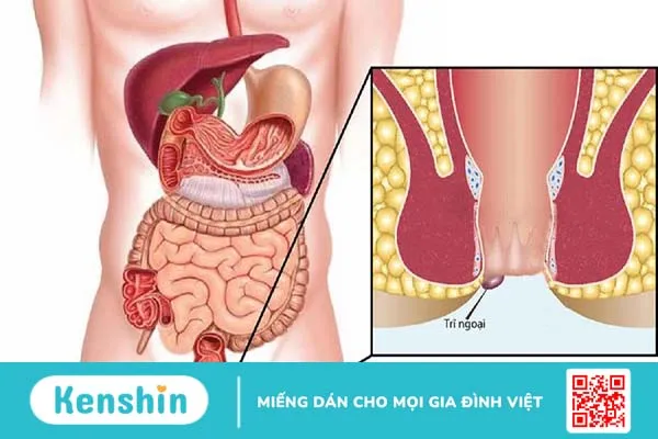 Thuốc Preparation H làm trơn niêm mạc ống hậu môn và giảm sưng, đau, sa búi trĩ sau khi đi đại tiện