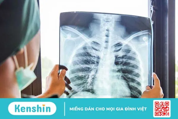 5 dấu hiệu cảnh báo cơ thể bạn không nhận đủ magiê 3