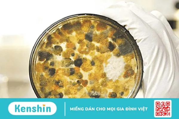 Aflatoxin là gì? Nguyên nhân nấm Aflatoxin có trong thực phẩm mốc dễ gây bệnh ung thư 1