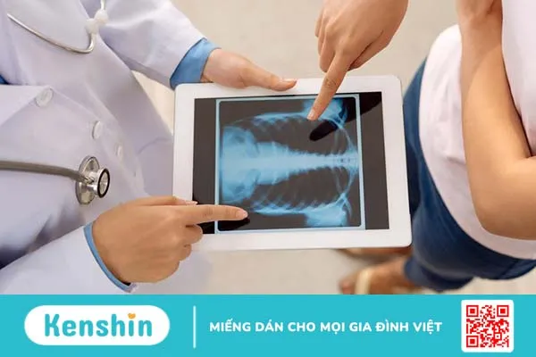 Ấn vào xương sườn thấy đau cảnh báo bệnh gì 1