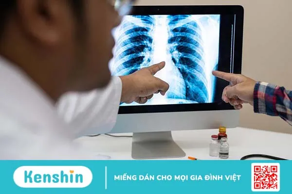 Ấn vào xương sườn thấy đau cảnh báo bệnh gì 4