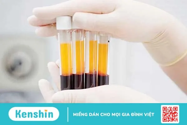 Angiotensin Aldosterone có vai trò gì trong điều hòa thể tích máu và huyết áp? 2