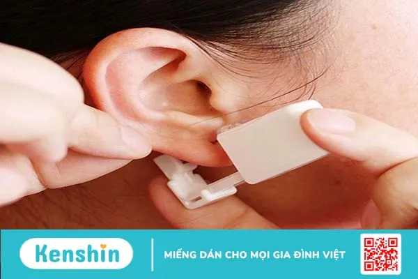 Nên bấm lỗ tai khi còn sớm để hạn chế đau và phục hồi tốt hơn