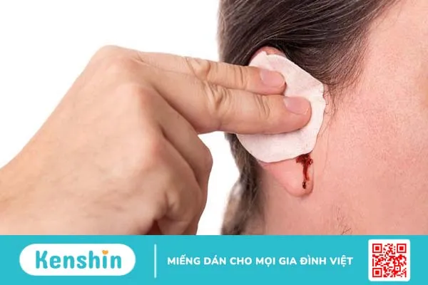 Bấm lỗ tai bị sưng mủ chảy máu - Giải quyết thế nào? 3