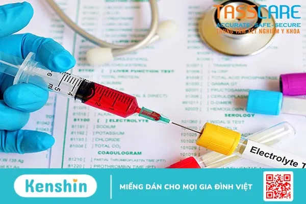 Bạn có biết Nguyên nhân gây ra bệnh bướu cổ basedow là gì 3