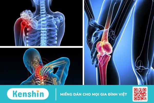 Cách sử dụng vỏ cây hoa sữa chữa xương khớp hiệu quả 3