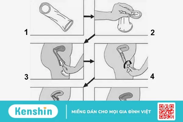 Cách đeo bao cao su cho nữ giới