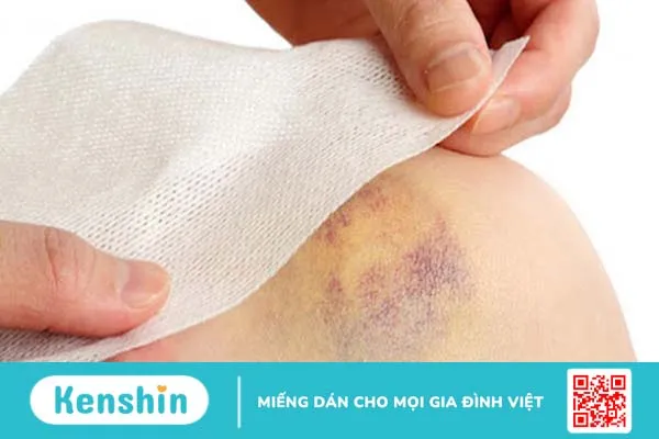 Bệnh bạch cầu cấp dòng lympho ở trẻ em - những yếu tố nguy cơ 2