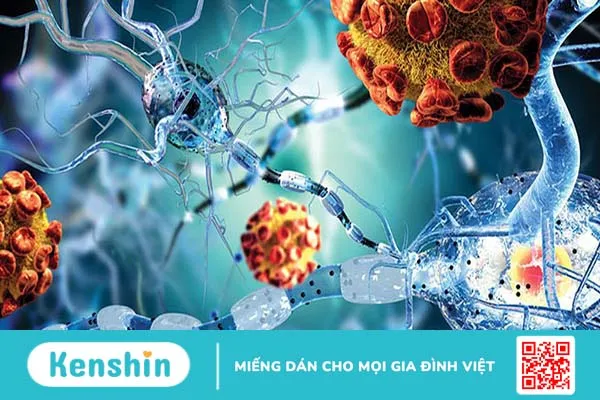 Hệ miễn dịch suy yếu là một trong những nguyên nhân gây ra bệnh Crohn ở người lớn