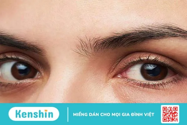 Bệnh fabry: Căn bệnh di truyền hiếm gặp 2