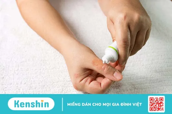 Bệnh ghẻ lở hắc lào là gì? Cách phân biệt ghẻ lở và hắc lào 3