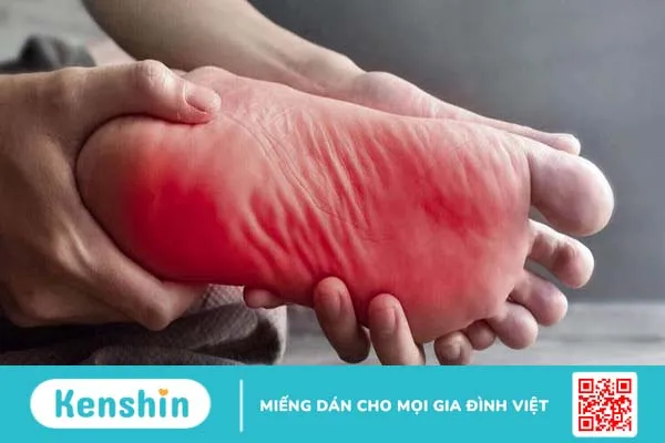 Bệnh nấm nông ở chân