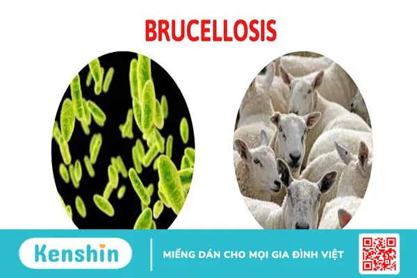 Bệnh truyền nhiễm brucella có nguy hiểm không? 1