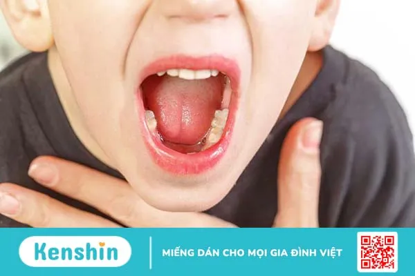 Bệnh viêm VA ở trẻ em có nguy hiểm không? 1