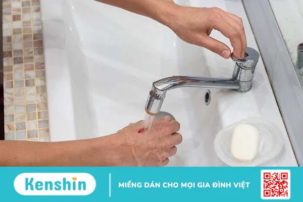 Bị chó nhà cắn có sao không? Cách xử lý như thế nào? 2