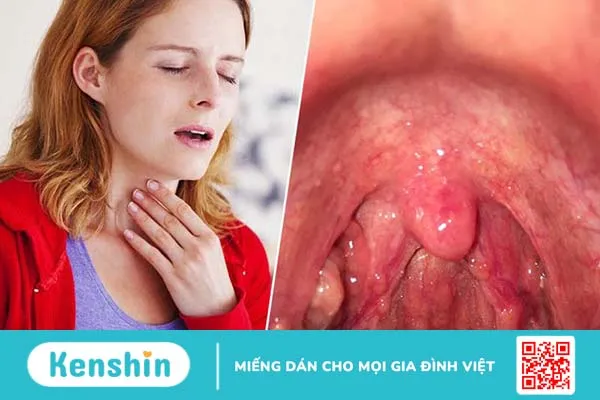 Bị cúm khi mang thai tuần đầu- Mẹ bầu cần làm gì? 2