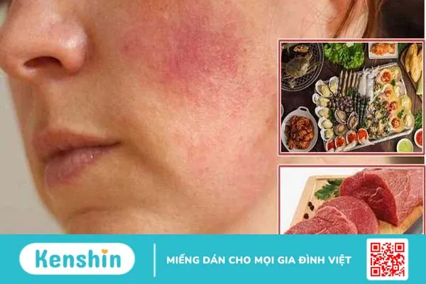 Bị dị ứng mỹ phẩm kiêng ăn gì? 2