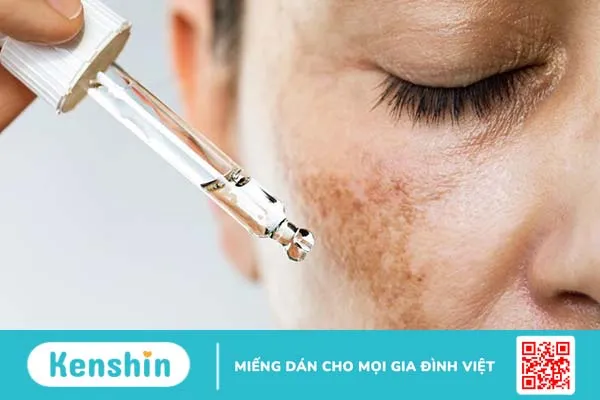 Toàn tập bí kíp dưỡng da cho bà bầu không thể bỏ lỡ 2