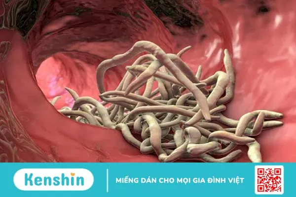 Bị nhiễm giun đũa chó khi mang thai có nguy hiểm không? Cách phòng tránh thế nào? 3