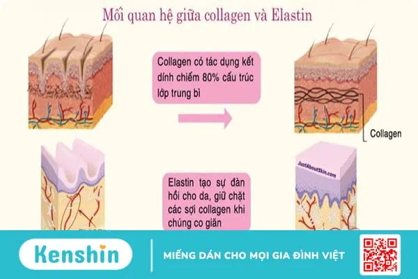 bị rạn da mông màu trắng 1