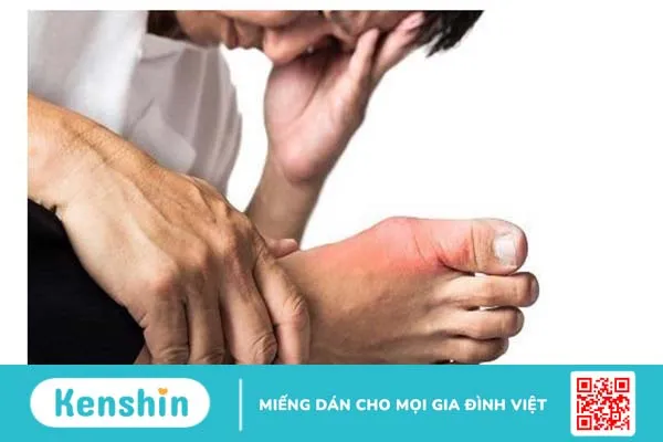 Biến dạng ngón chân cái là do đâu? Cách xử lý như thế nào? 2