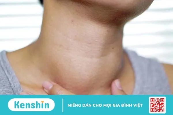 Bướu cổ ăn cải thảo được không? Thực phẩm nên ăn và nên tránh khi bị bướu cổ 1