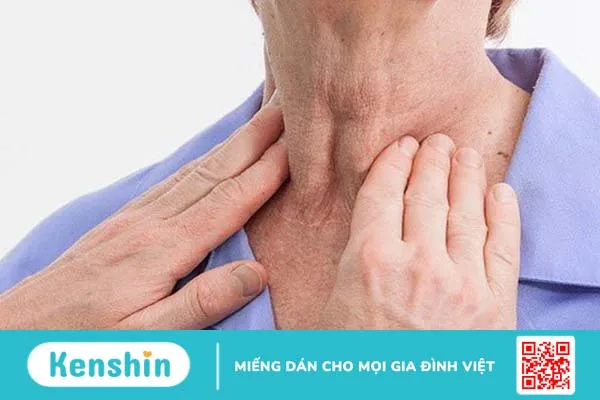 Bướu cổ basedow có lây không? Nguyên nhân, biểu hiện và cách điều trị đúng 2