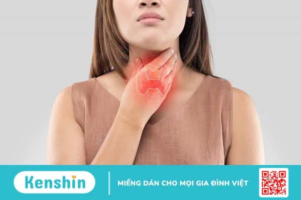 Bướu cổ đa nhân lành tính Nguyên nhân, triệu chứng và cách phòng ngừa 2