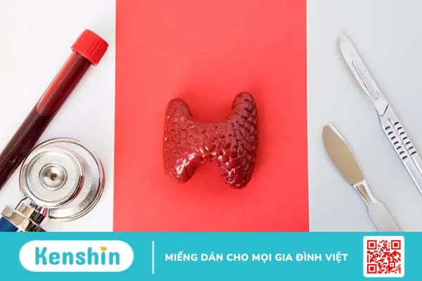 bướu cổ di căn 2