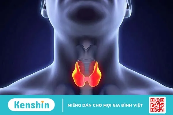 Bướu cổ lành tính có đau không Cách chữa bệnh bướu cổ lành tính 1