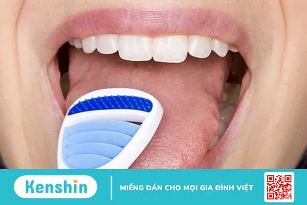 Các bệnh về lưỡi thường gặp: Nguyên nhân, triệu chứng và hướng điều trị 7