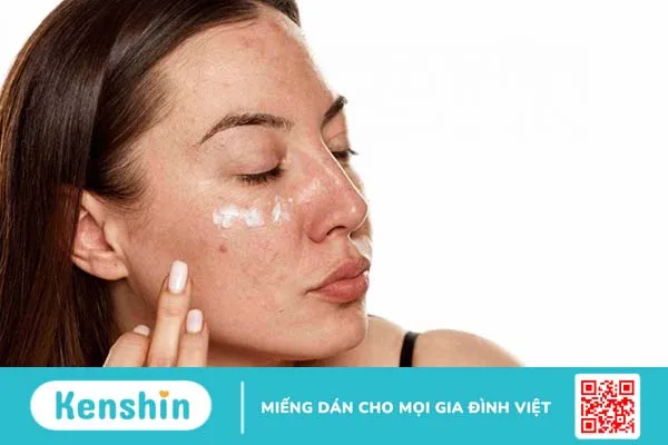 Các đốm đồi mồi có lan không? 4