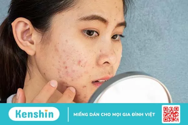 Các loại mụn viêm dưới da và cách điều trị 4