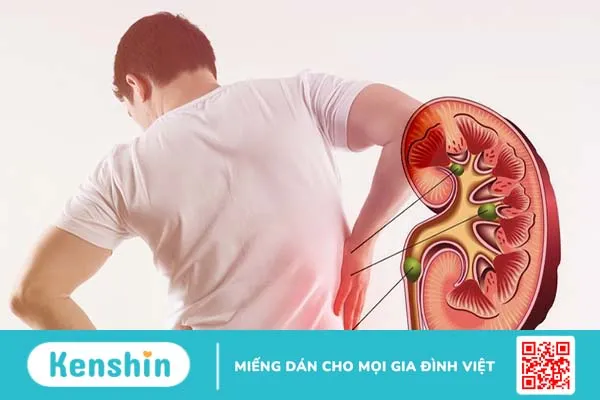 Đau lưng do nguyên nhân nào? Các vị trí đau lưng nguy hiểm bạn cần biết 3