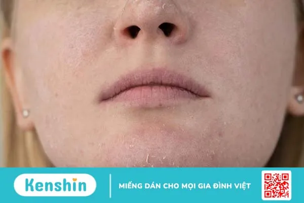 Lưu ý cách chọn kem dưỡng cho da treatment 2