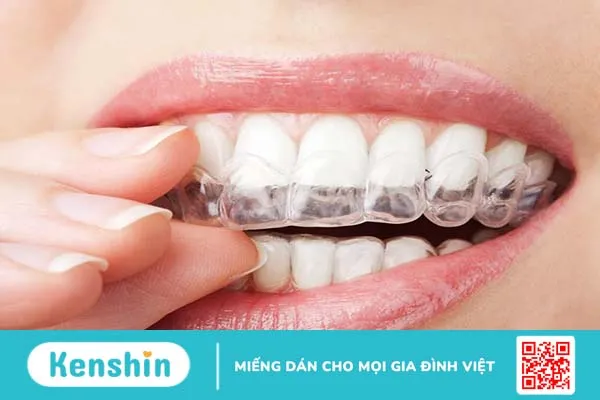 Cách khắc phục răng mọc chồi như thế nào cho hiệu quả? -4