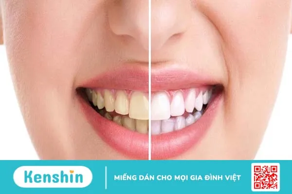 Thay vì súc miệng có thể chà xát dầu dừa lên răng để tẩy trắng răng