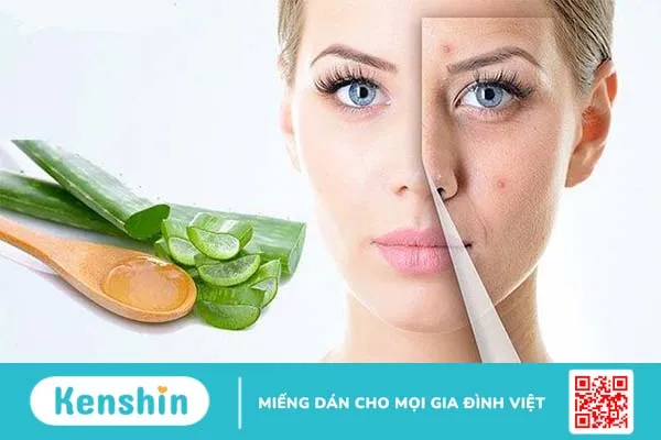 Cách làm xẹp mụn sưng đỏ sau 1 đêm bạn đã biết chưa? 2