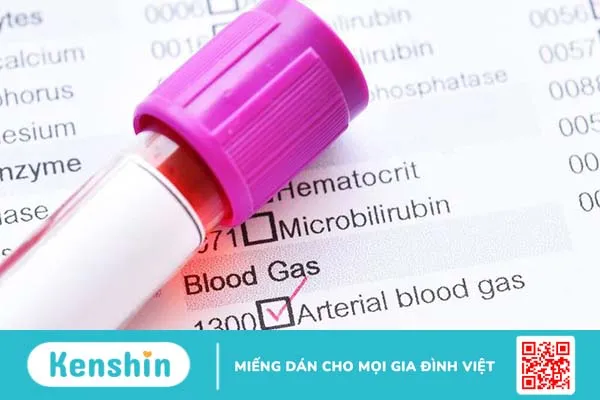 Cách lấy khí máu động mạch làm xét nghiệm như thế nào? Những lưu ý cần biết 1