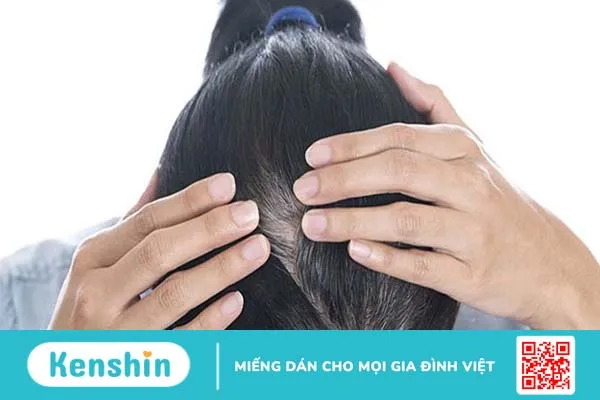 Gội đầu bằng hà thủ ô là phương pháp không những khắc phục tình trạng rụng tóc mà còn giúp ngăn ngừa tóc bạc sớm