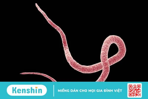 [Chia sẻ] Cách nhận biết các triệu chứng đau bụng giun ở trẻ em 1