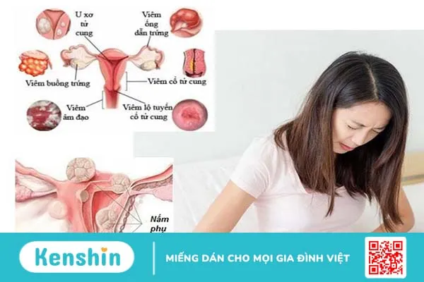 Bệnh phụ khoa là các bệnh vùng kín phụ nữ thường mắc phải