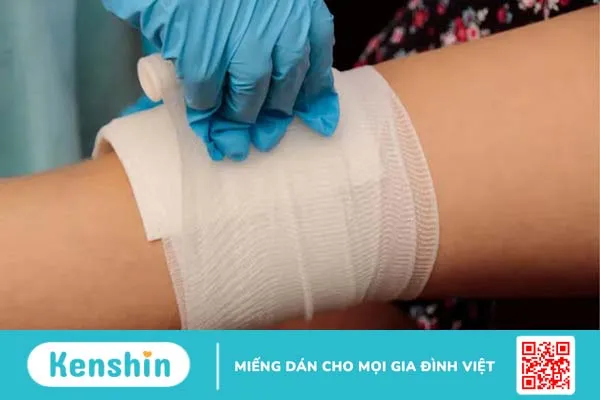 Sơ cứu vết thương chảy máu mao mạch và tĩnh mạch đúng cách, an toàn 3