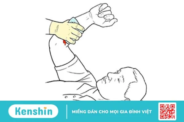 Sơ cứu vết thương chảy máu mao mạch và tĩnh mạch đúng cách, an toàn 4