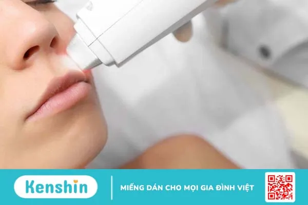 Chỉ nên tẩy ria mép bằng kem đánh răng nguyên chất có màu trắng