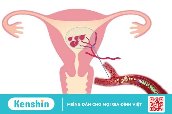 Cách tống sản dịch sau sinh mổ nhanh chóng cho thai phụ -1