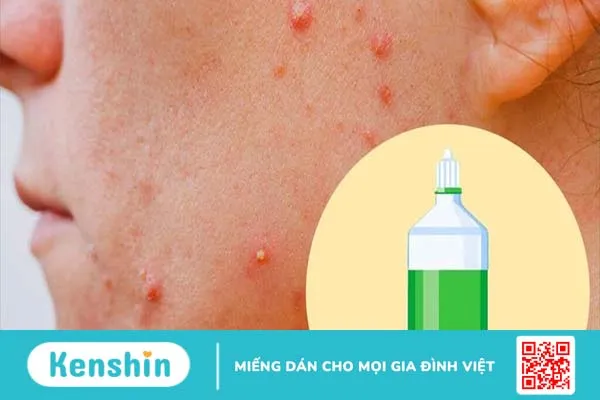 Cách trị dị ứng da mặt bằng nước muối hiệu quả 1