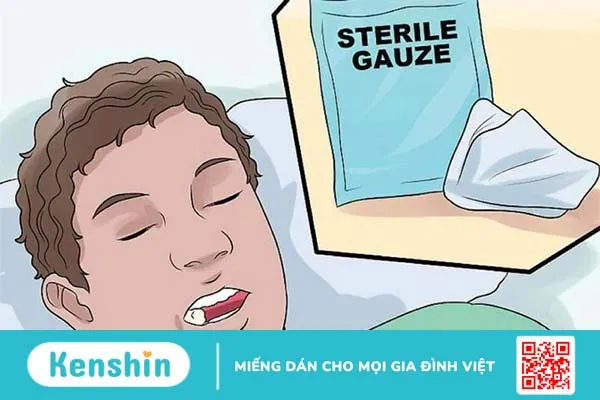 Cần ngậm bông gòn bao lâu sau khi nhổ răng? 1