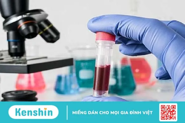 Kháng thể kháng cardiolipin antibody là gì? -3